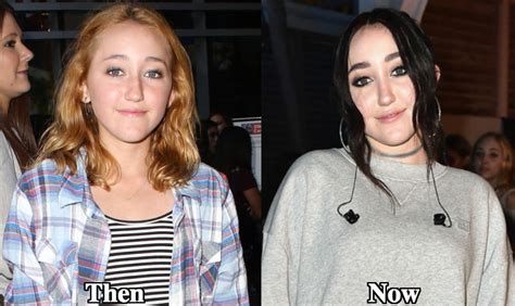 noah cyrus before after|We Cant Stop Staring At Noah Cyrus Transformation